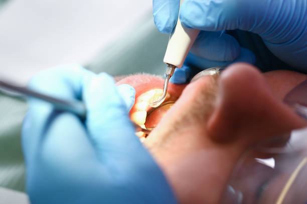 Best Emergency Dentist for Knocked-Out Tooth in Rockmart, GA