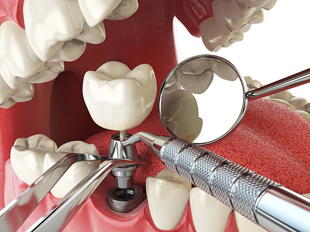 Best Emergency Dental Care for Abscessed Tooth in Rockmart, GA